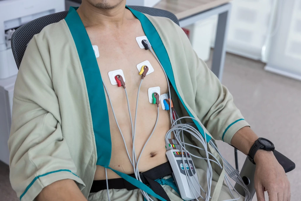 Holter Study – 48 Hours (Home Visit)